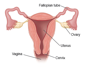 Cross-section of uterus with Fallopian tubes, ovaries, cervix, and vagina.