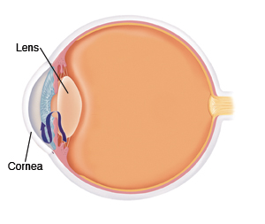 Location of lens and cornea in eye.