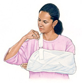 Woman with arm in sling