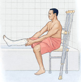 Person with fiberglass splint on leg sitting on shower chair with leg propped up on side of bathtub.