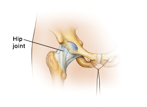 Close-up of hip joint connecting upper leg bone to hip bone.