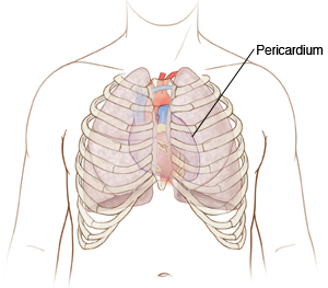 Outline of chest showing heart's placement behind ribs and pericardium.