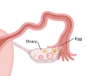 Egg being released from ovary.