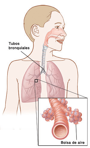 tubos bronquiales, bolsa de aire