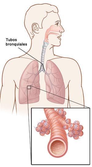 tubos bronquiales