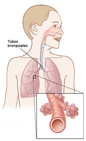 tubos bronquiales