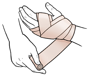 One hand wrapping an Ace bandage around the other.