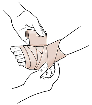 Adult hands wrapping child's ankle with elastic bandage.