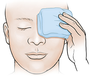 Person holding cold compress on eye.