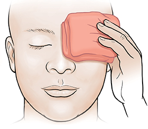 Person holding cool compress on eye.