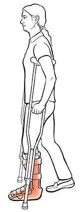 Side view of woman using crutches.