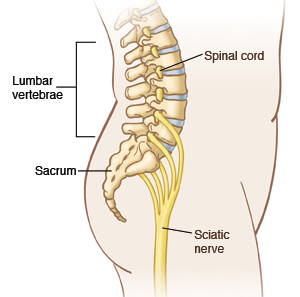 Side view of lower back showing lumbar vertebrae, sacrum, and sciatic nerve.