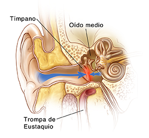 Vista frontal de un corte transversal del oído externo, medio e interno que muestra la presión que se ejerce sobre ambos lados del tímpano.