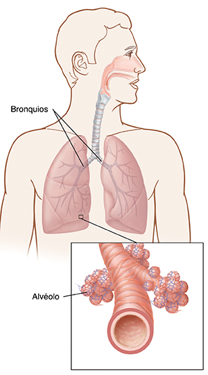 Ilustración que muestra la posición de los pulmones y los bronquios con un primer plano de un alvéolo.