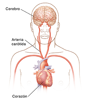 Vista frontal de la cabeza y la parte superior del cuerpo en donde pueden verse las arterias carótidas, el corazón y el cerebro.