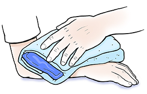 Closeup of adult hand holding ice pack wrapped in towel on child's forearm.