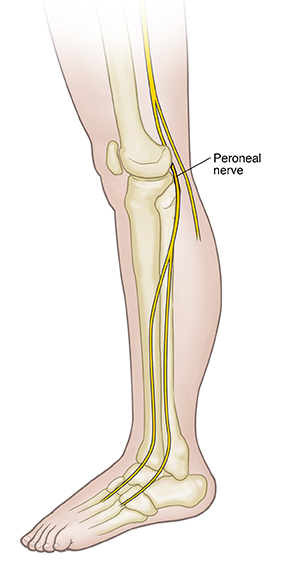 Side view of leg showing bones and peroneal nerve.