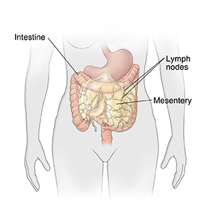 Front view of woman's abdomen showing stomach, intestine, mesentery, and mesenteric lymph nodes.