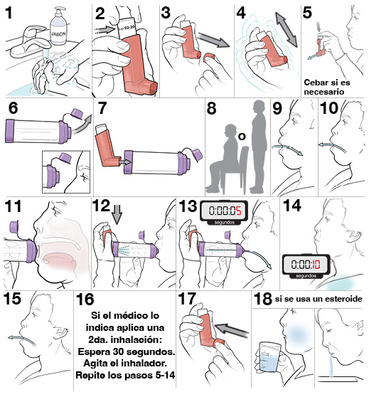 17&nbsp;pasos para usar un inhalador de dosis medida con espaciador