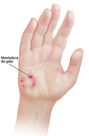 Palma de una mano con marcas de mordida de gato.