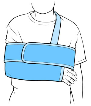 Front view of person wearing a sling and swathe. 