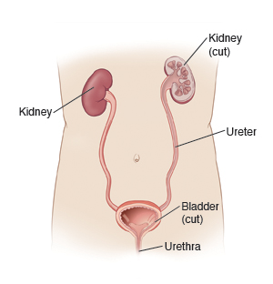 Outline of the body with the organs of the urinary system, including the kidneys, ureter, bladder, and urethra.