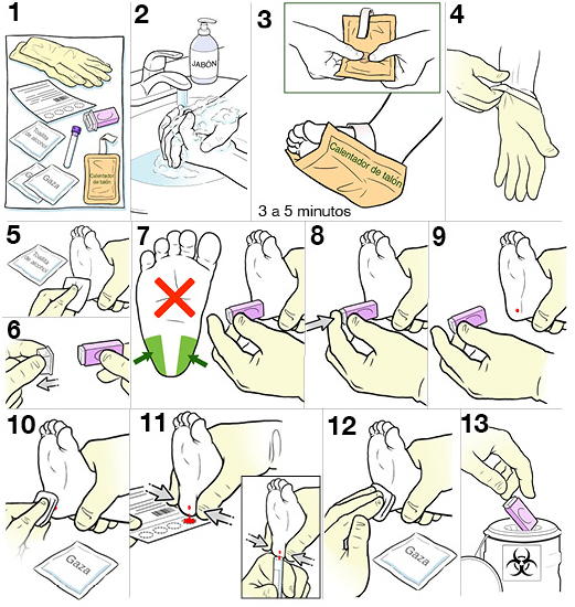 13 pasos para hacer una punción de talón a un bebé.
