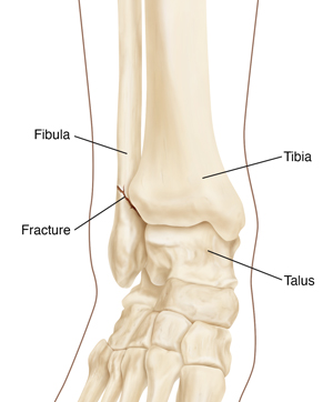Skeleton view of foot, ankle, and ends of fibula and tibia.