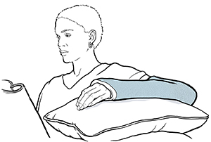 Woman on couch resting arm in cast on pillows.