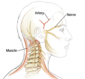 The head showing the muscles of the neck, an artery in the brain, and facial nerves