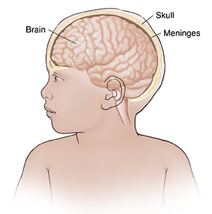 Front view of child with head turned showing skull, brain, and meninges.
