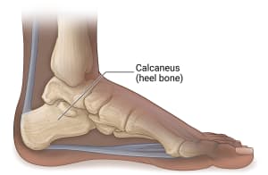 The large bone at the heel of the foot is called the calcaneus (heel bone).