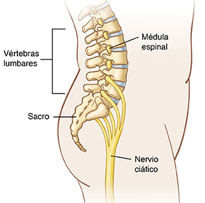 Contorno de la vista lateral de un cuerpo en donde se observa la posición de las vértebras lumbares, el sacro y el nervio ciático.