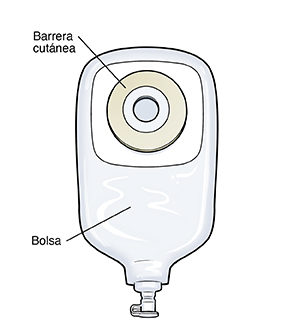 Bolsa de urostomía drenable de una sola pieza