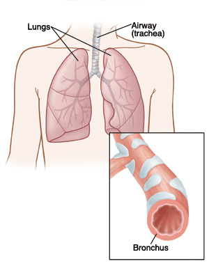 Lungs and trachea and closeup of bronchus.