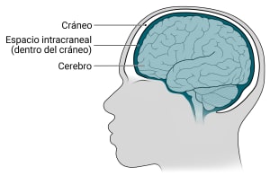 Dentro de la cabeza, el cerebro se encuentra dentro del cráneo con un espacio entre ellos denominado espacio intracraneal.