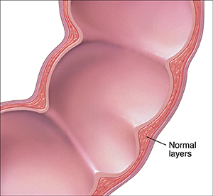Cross section of colon showing normal layers of intestine wall.