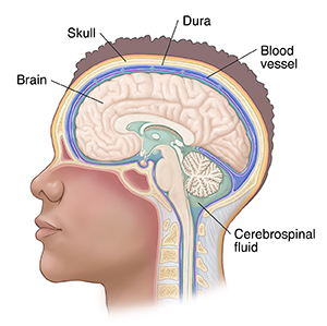Side view of head, showing brain, skull, dura, blood vessels, and cerebrospinal fluid.