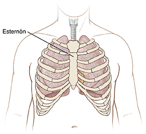 Vista frontal del pecho de un hombre donde se observa un esternón y la caja torácica.