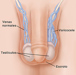 Pene, escroto y testículos que muestran venas normales y varicocele. 