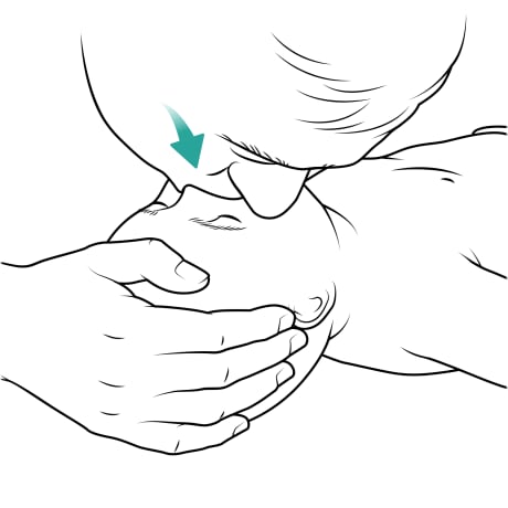 Person with their hand on baby's forehead and their mouth over baby's nose and mouth, giving rescue breath.