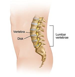 Side view of male figure showing lumbar spine anatomy, including vertabrae and discs.