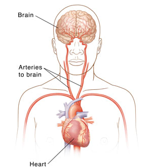 Front view of head and upper body showing carotid arteries, heart, and brain.