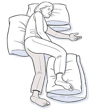 Person lying on side affected by stroke, with pillows supporting head, back, and unaffected leg.