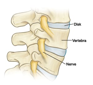 Side view of lumbar spine showing vertebrae, disks, and nerves.