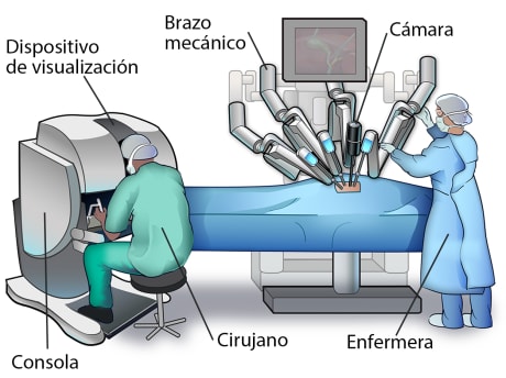 Sala de operaciones en la que se ve al personal quirúrgico utilizando un dispositivo quirúrgico robótico.