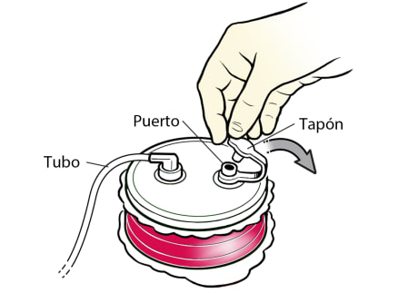 Primer plano de una mano enguantada que abre el tapón de un drenaje Hemovac lleno.