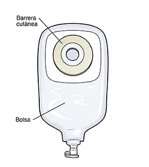 Bolsa de urostomía de una sola pieza con sistema de vaciado.