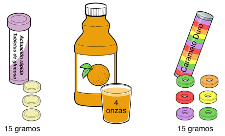 Ejemplos de 15 gramos de carbohidratos, que incluyen 3 comprimidos de glucosa, 4 onzas de jugo y 6 caramelos.